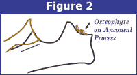 http://offa.org/images/edfig2.gif