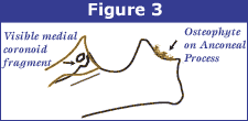 http://offa.org/images/edfig3.gif