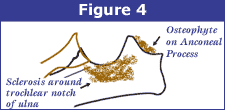 http://offa.org/images/edfig4.gif